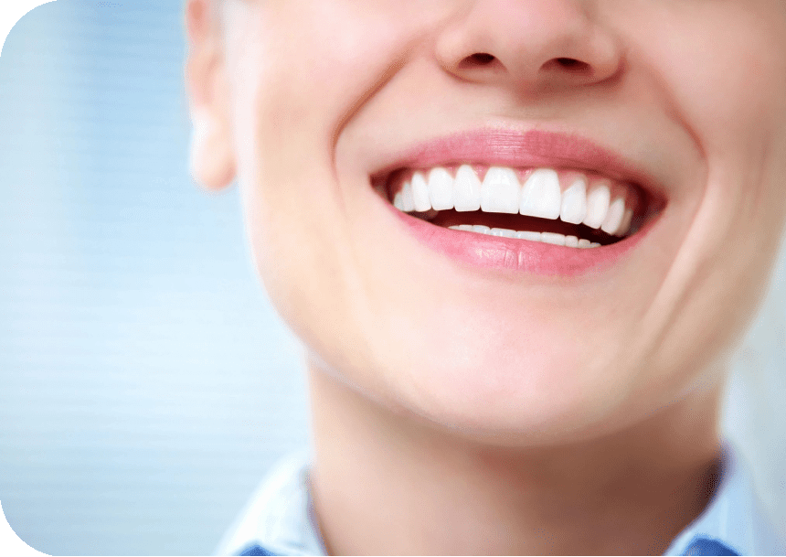 h1(3) A close up of a person 's smile with teeth.